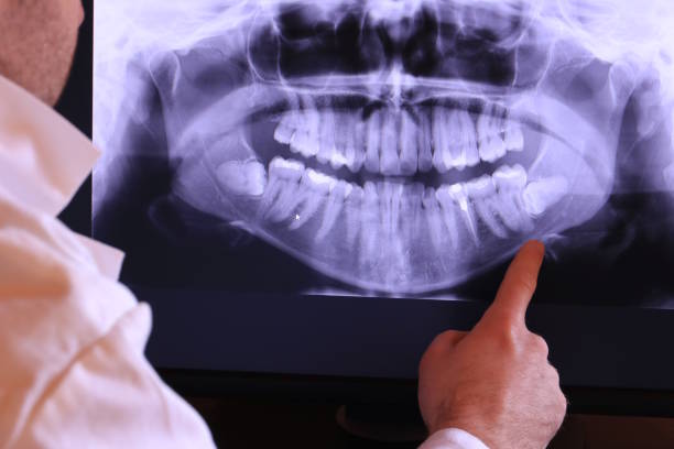 Best Emergency Treatment for Jaw Pain or Injury in St Pauls, NC